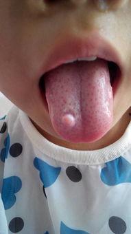 吃小白瓜舌头难受,小白瓜引发的不适体验 第2张 吃小白瓜舌头难受,小白瓜引发的不适体验 第2张