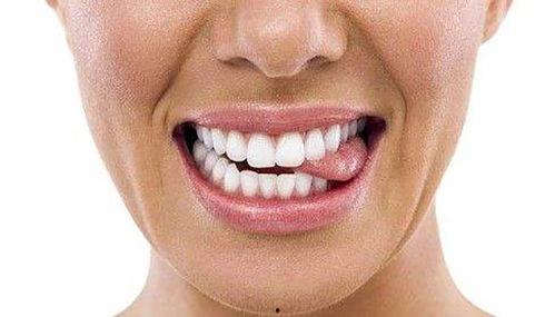 吃小白瓜舌头难受,小白瓜引发的不适体验 第3张 吃小白瓜舌头难受,小白瓜引发的不适体验 第3张