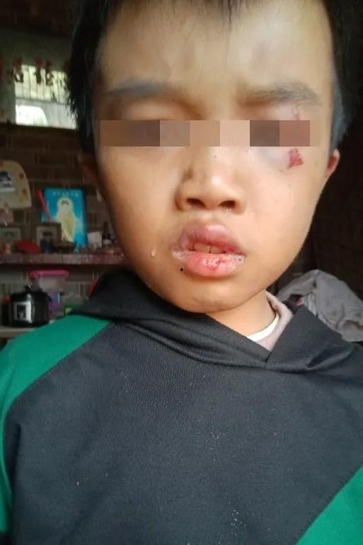 吃瓜12岁男孩,揭秘网络“吃瓜”文化的魅力与隐忧